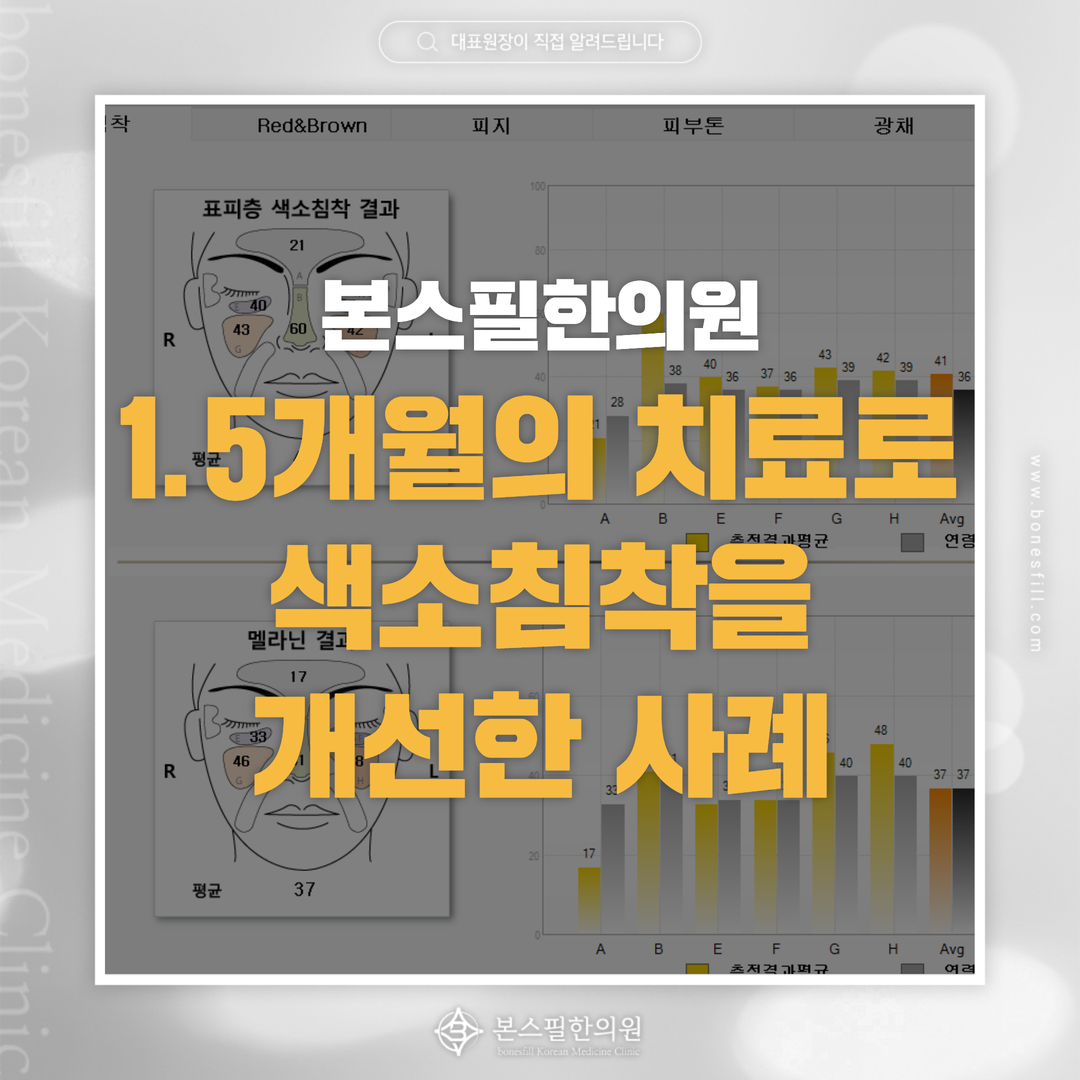 1.5개월의 치료를 통해 색소침착 증상이 완화된 환자분의 사례